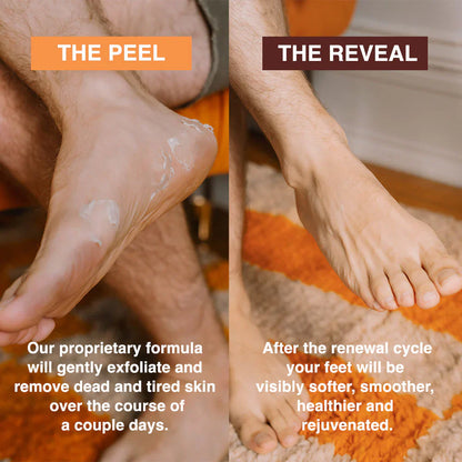 Sadoer Glycolic Acid Foot Peeling Mask (1 Pair), Korean Peeling & Exfoliating | Deep Exfoliation with Glycolic Acid, Removes Dead Skin, Cruelty-Free, Foot Peel Off Mask
