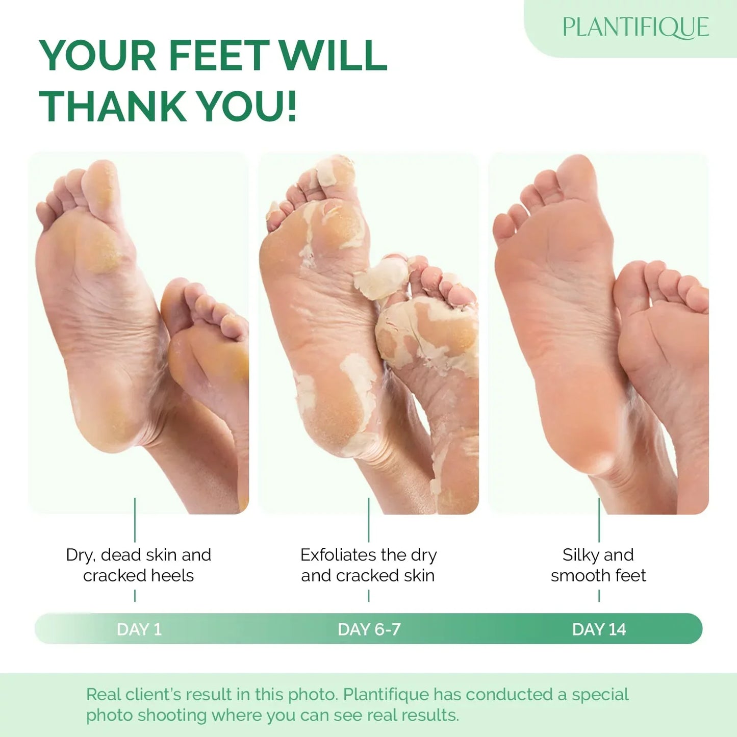 Sadoer Glycolic Acid Foot Peeling Mask (1 Pair), Korean Peeling & Exfoliating | Deep Exfoliation with Glycolic Acid, Removes Dead Skin, Cruelty-Free, Foot Peel Off Mask
