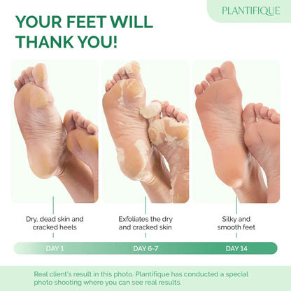 Sadoer Glycolic Acid Foot Peeling Mask (1 Pair), Korean Peeling & Exfoliating | Deep Exfoliation with Glycolic Acid, Removes Dead Skin, Cruelty-Free, Foot Peel Off Mask