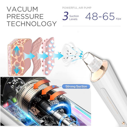 GlowSkin™ Portable Blackhead Remover